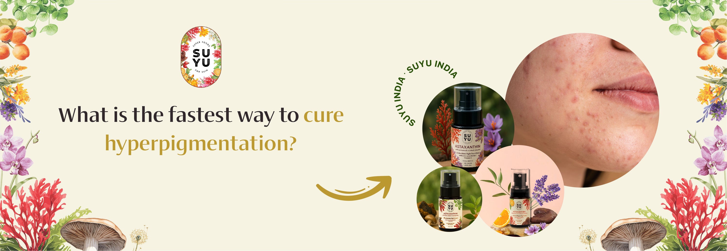 Hyperpigmentation