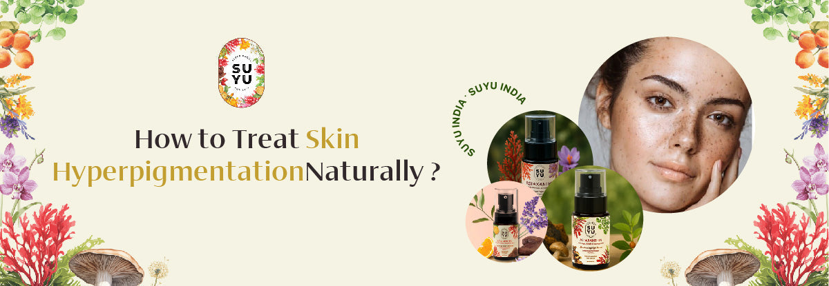Hyperpigmentation Naturally