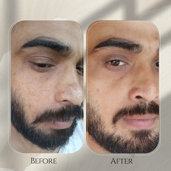 Ankit Brar